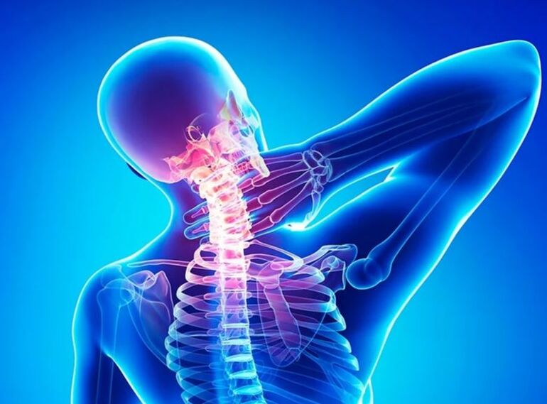 Osteochondrosis Bay of spine