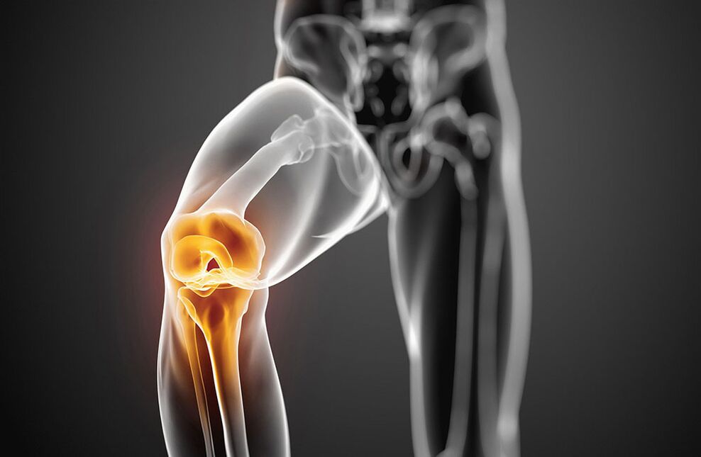 Knee wrist arthrosis