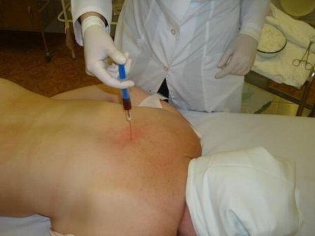 Treatment for injections